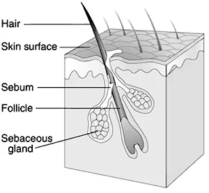 Is Your Hair Thinning?